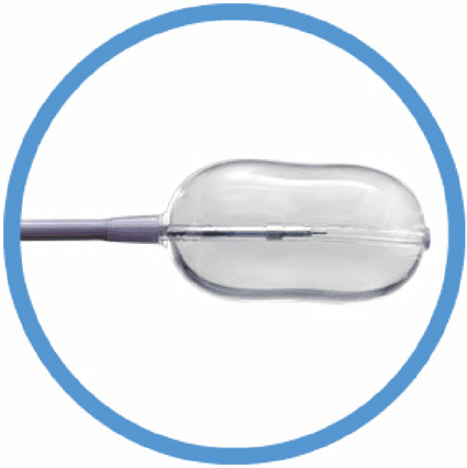 Image: The Kyphon Xpander II inflatable bone tamp (photo courtesy Medtronic).
